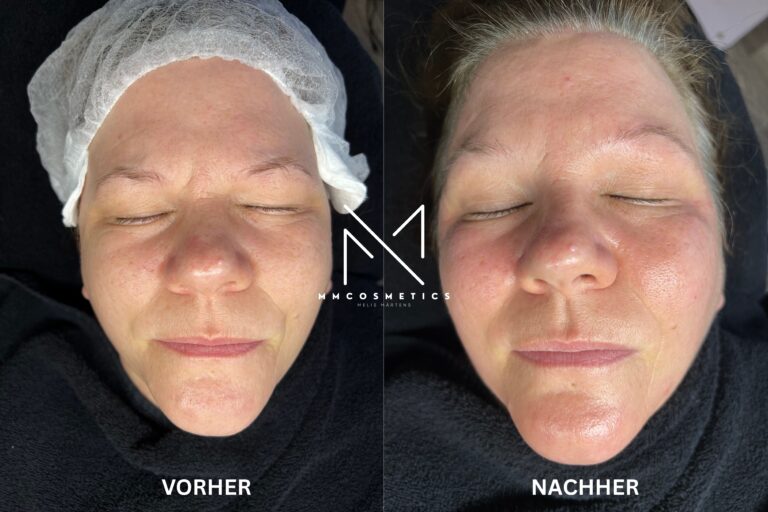 voher.jpg